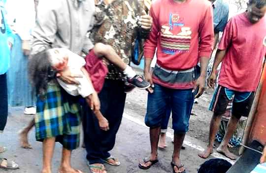 Lakalantas yang terjadi di Desa Bolo Kecamatan Madapangga, Selasa (16/8/2016) menewaskan dua anak.